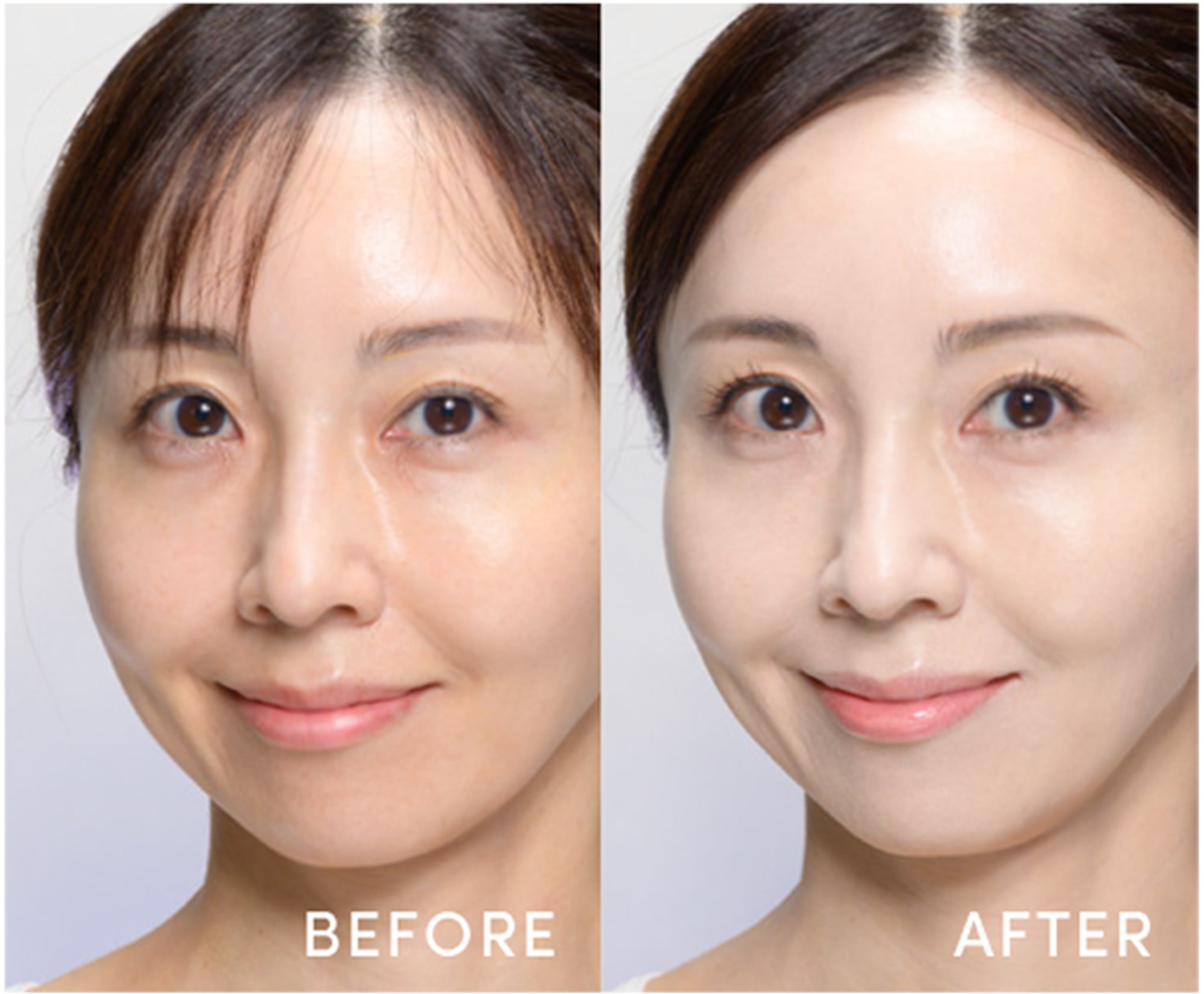 Skintuition 30 SPF Before / After Photos - 10 Fair