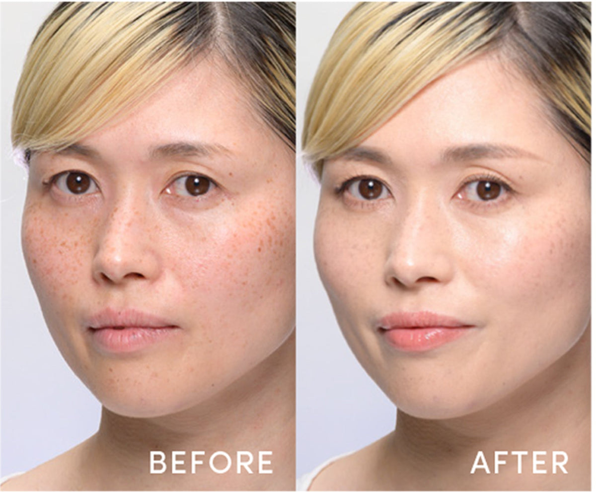 Skintuition 30 SPF Before / After Photos - 26 Light – Janeiredale