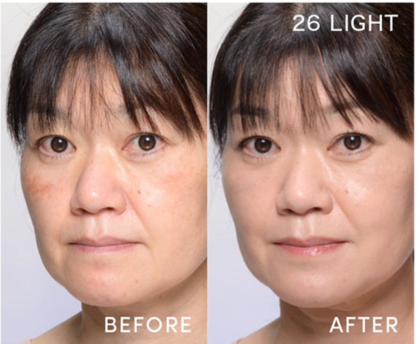 Before / After - 26 Light