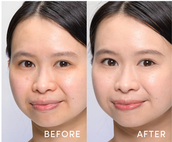 Before / After - 26 Light