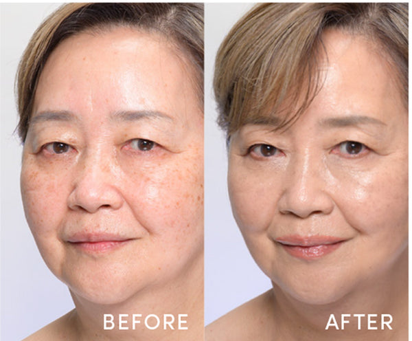 Before / After - 28 Light