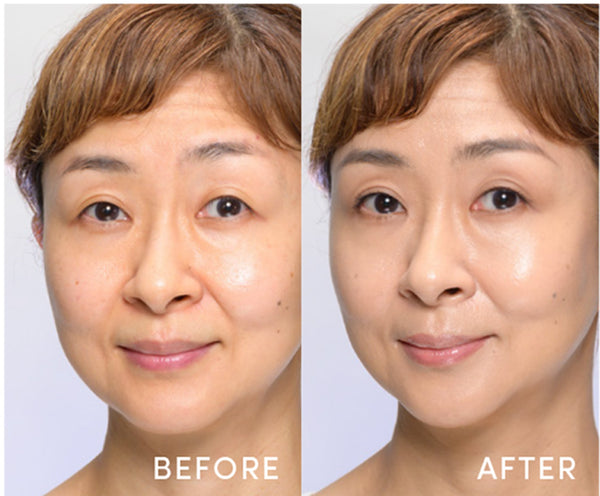 Before / After - 28 Light