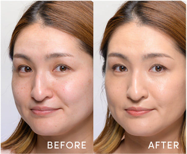 Before / After - 36 Light Medium